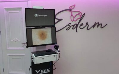VIDIX – videodermatoscopul digital revolutionar